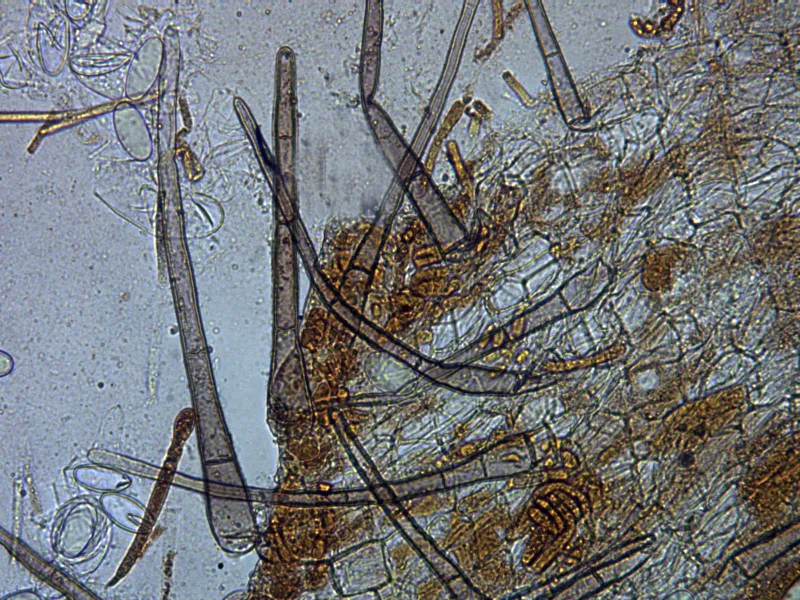 Cheilymenia pulcherrima 12 - Pelos agua x 400